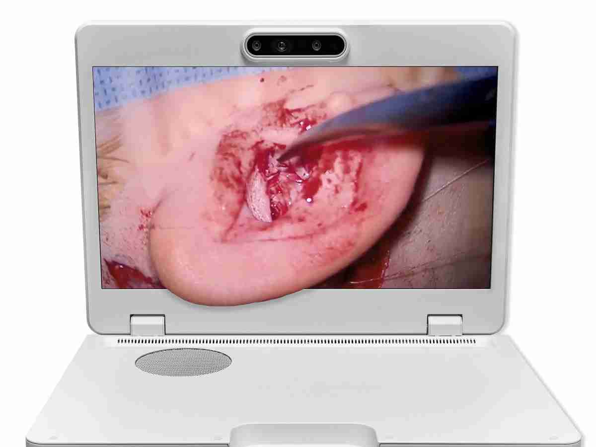 达擎之＂Heads-up 3D显微手术显示系统＂，，整合4K裸眼3D显示及眼球追踪系统，，，，具备快速追踪人眼移动位置功能，，减轻医师长时间维持固定姿势的负担，，让医师能有更宽广清晰的3D立体视野及更舒适的姿势来执行手术。。。。